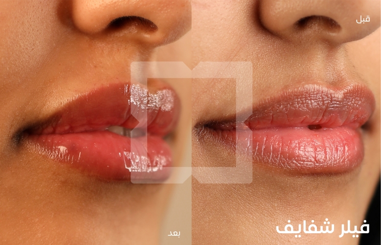 N6_ar
